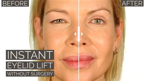 Instant Eye Lift Techniques: Simple Ways to Refresh Your Appearance